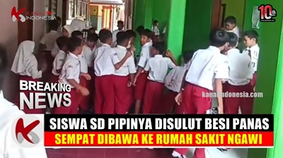 Video Siswa SD di Ngawi Disulut Besi Panas Teman Sekelas, Pipi Melepuh