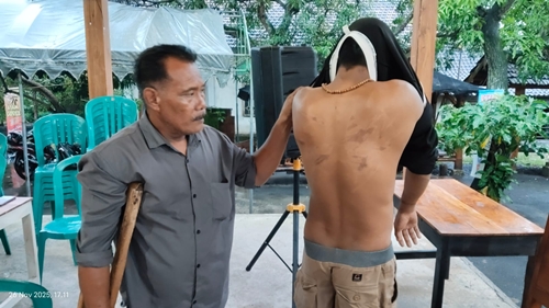 Diduga Dianiaya Oknum Polisi Dituduh Maling, Warga Tuban Lapor ke Polda Jatim